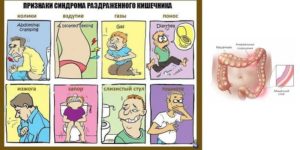 Синдром раздраженного кишечники и гомеопатия